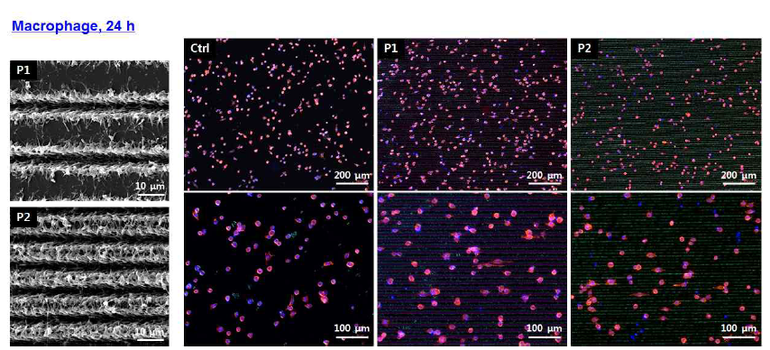 표면의 Macrophage 결과