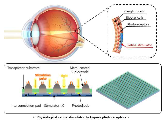 본 연구개발의 최종목표: 망막의 생리학적인 신호전달 및 처리 과정을 모사할 수 있도록 sub-retina 형태의 자극 전극을 구현하고자 하며, 광학적으로 투명하여 그 아래에 위치한 포토다이오드에 빛을 전달할 수 있고, 목표로 하는 biopolar cell과의 거리를 최소화 할 수 있는 돌출된 구조의 3차원 신경전극 기술 개발