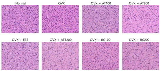 골다공증 OVX 동물모델에서의 산겨릅나무에 의한 간 조직 변화
