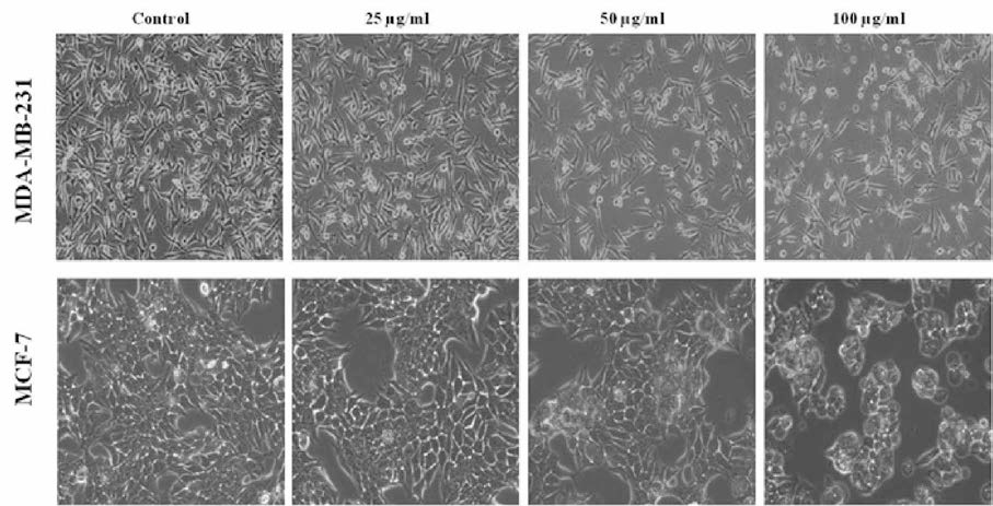 오갈피 주출물의 n-Hex 분획을 처리한 MCF-7, MDA-MB-231 세포의 형태학적 변화