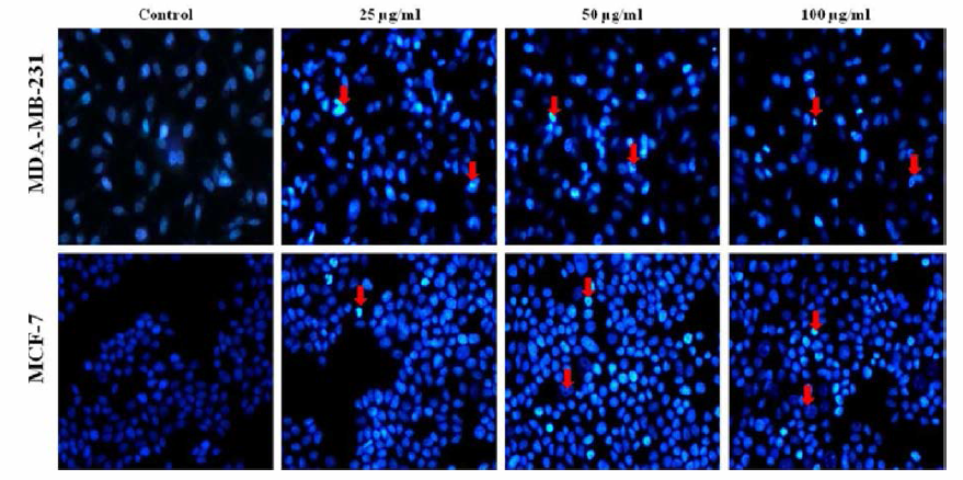 오갈피 추출물의 n-Hex 분획을 처리한 MCF-7, MDA-MB-231 세포의 핵 변화 관찰