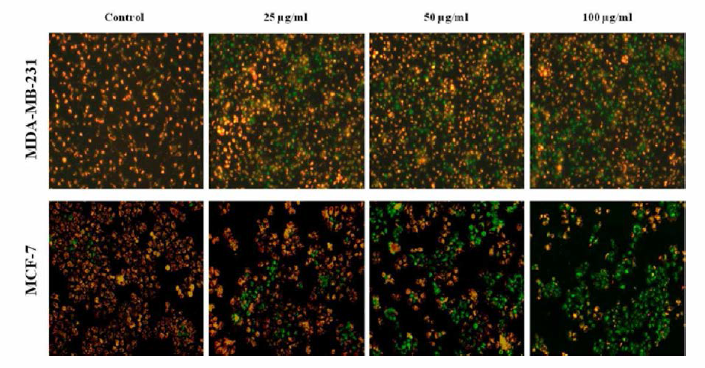 오갈피 추출물 n-Hex 분획이 인체 유방암 세포 MCF-7과 MDA-MB-231의 mitochondrial membrane potential (MMP)에 미치는 영향