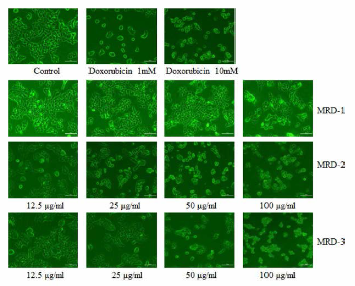 Morphological changes of MCF-7 cells treated with various concentrations of compounds for 24 hr