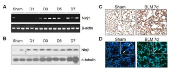WT 마우스에 Bleomycin (BLM) 처리에 따른 Ninjurin1의 발현 변화