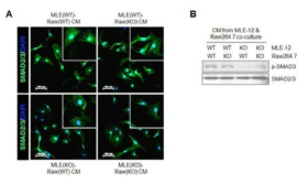 Fibroblast에서 폐상피세포와 macrophage의 conditioned medium의 신호전달 효과