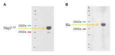 His tag을 이용한 Ninjurin1 재조합 단백질 정제