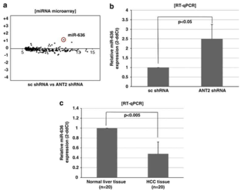 Knockdown of adenine nucleotide translocase 2 (ANT2) by short hairpin RNA (shRNA) induces specific restoration of miR-636 in Hep3B and expression of miR-636 was remarkably lower in hepatocellular carcinoma (HCC) tissue