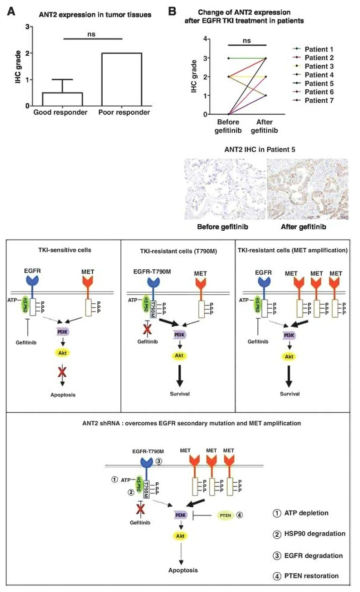 Expression levels of ANT2 in tumor tissues from NSCLC patients treated with gefitinib