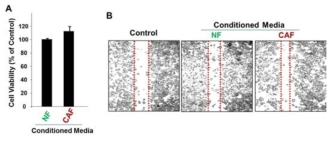 NF와 CAF세포를 배양한 conditioned media에 의한 유방암 세포의 증식과 이동