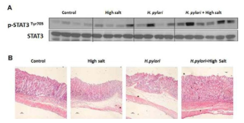 H.pylori 감염과 고염식이로 유도된 마우스 위염 모델에서 STAT3 인산화 증가