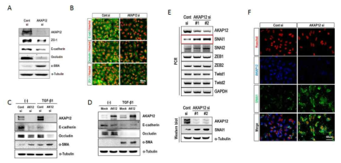 AKAP12의 EMT에 의한 전이 조절작용 연구