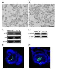 Zebrafish 망막모세포종 동소이식 모델