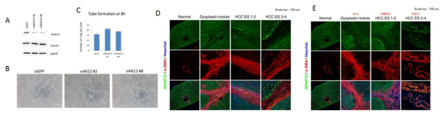 AKAP12에 의한 간암미세환경 조절