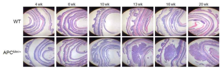 WT 마우스와 APCMin/+ 마우스의 대장암 발병 조직학적 분석