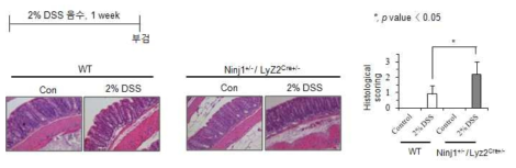 정상 마우스와 Ninjurin1/Lyz2Cre 마우스에서 대장염 발생 차이 조직학적 분석