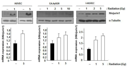 혈관세포에서 방사선 조사 후 Ninjurin1 발현