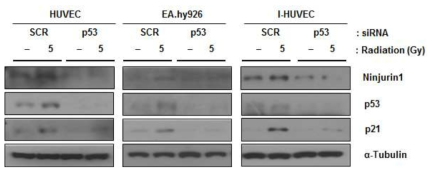 혈관세포에서 방사선 조사 후 Ninjurin1 발현