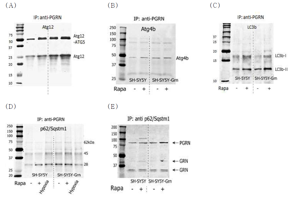 Coimmunoprecipitation of progranulin with autophagy proteins. A: Immunoprecipitation (IP) with anti-progranulin and subsequent immunoblot analysis of ATG12 in SH-SY5Y neuroblastoma cells without (SH-SY5Y) and with progranulin overexpression (SH-SY5Y-Grn) without/with rapamycin stimulation. B, C, D: IP of progranulin and immunoblot for ATG4b, LC3b and p62/Sqstm1, respectively. E: Immunoprecipitation of p62/Sqstm1 in SH-SY5Y cells and subsequent immunoblot of progranulin. Representative results of at least 3 experiments each