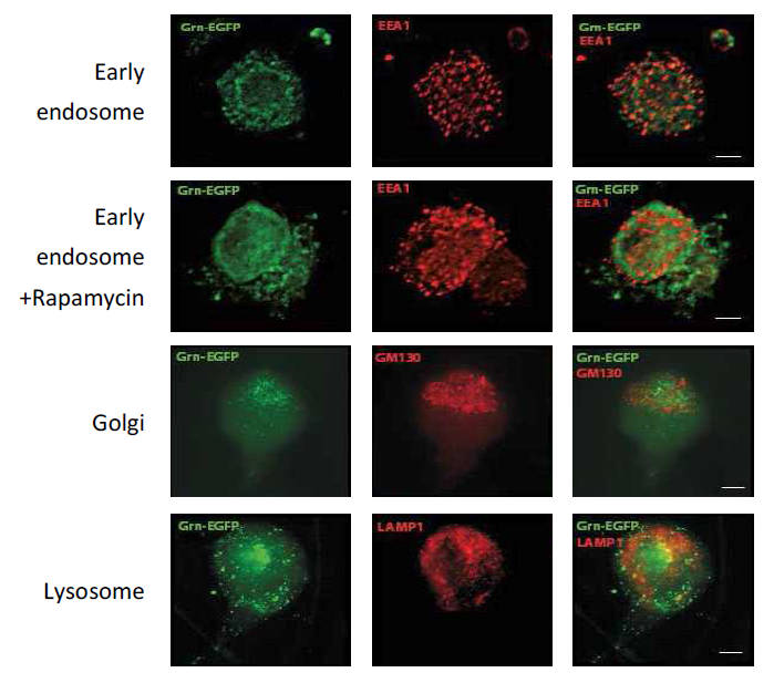 Immunofluorescence analysis of the subcellular localization of progranulin relative to early endosome (EEA1), Golgi structures (GM130) and the lysosome (LAMP1) in primary DRG neurons of adult mice. Sortilin is integrated into the plasma membrane or localized in early endosomes and was previously found to drag PGRN to multivesicular bodies. Neurons were transduced with Grn-EGFP fusion construct and detected by anti-EGFP immunofluorescence. Progranulin was not found in colocalization with sortilin, EEA1 or GM130 and weakly with LAMP1 after rapamycin stimulation. Scale bar 10μm