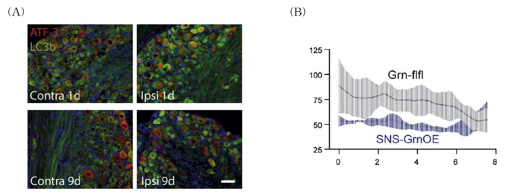 Autophagy after nerve injury and its impact on neuropathic pain. (A) Immunofluorescence analysis of LC3b-EGFP on time course in the DRGs transduced with mPGRN-expressing virus after crush injury of the sciatic nerve. The contralateral side was used as control. Images are presented as blue-to-yellow pseudocolor. Scale bars 50μm, (B) Quantification of calcium flux along the nerve proximal of the lesion in primary sensory neurons transduced with control or PGRN-overexpressing virus. (mean ± SD of n= 3 mice per group)