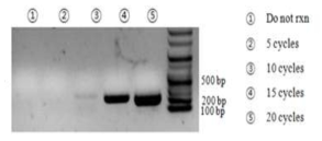 PCR 수행 후 증폭된 유전자의 gel 사진