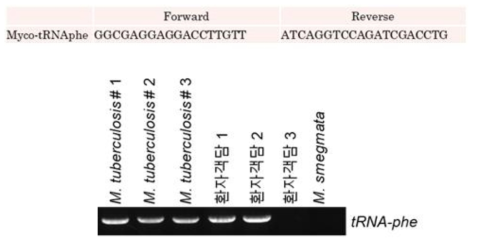 Core-gene tRNA-phe 진단 마커와 이를 이용한 PCR 산물