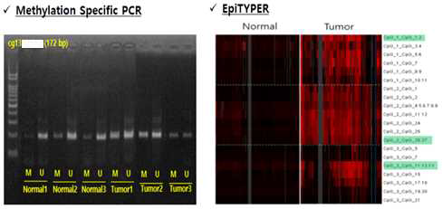 간암 진단 마커 후보군에 대한 MSP 및 EpiTYPER 결과