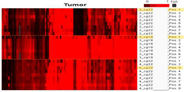 set-up이 완료된 3개 간암 진단 마커에 대해 간암 샘플에서의 Pyro-sequencing 결과. (X축: 환자, Y축: 타겟과 타겟 전후 지역. 노란박스로 표시된 타겟과 표 22에 표시된 CpG site의 메틸화 정도의 heatmap)