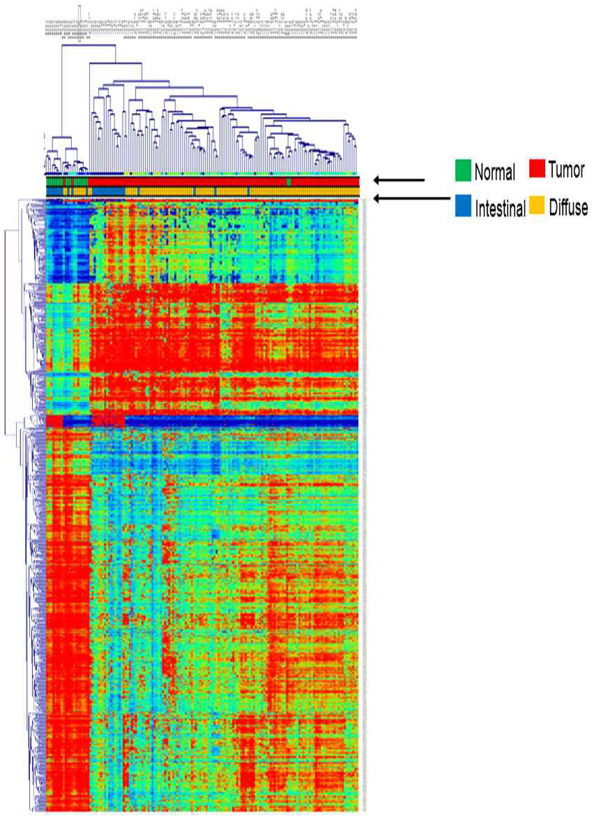 위암 코호트 150예에서 장형 및 미만형 위암에서의 DNA 메틸화 차이 패턴