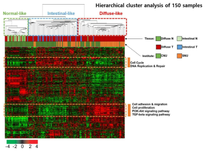 SD>0.9 기준으로 유전자 필터링 (총 3,586개 유전자) 후 수행한 hierarchical clustering 및 heatmap 분석. 미만형 위암이 크게 Intestinal-like 및 Diffuse-like 아류형으로 구분되어 있음