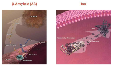 알츠하이머의 주요 바이오마커이자 타깃인 아밀로이드베타와 타우 단백질
