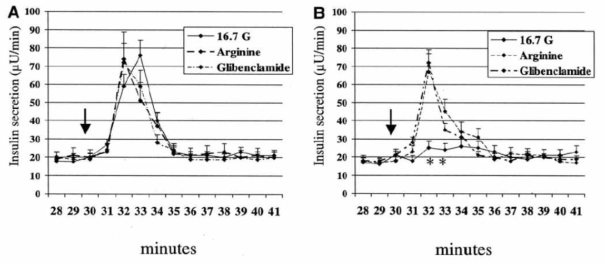 Insulin secretion from type 2 diabetic islets during perifusion experiments in control islets (A) and type 2 diabetic islets (B)