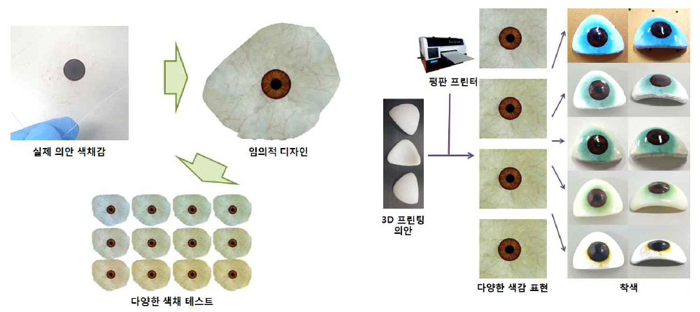 평판 프린터를 이용한 Resin 의안의 색감에 따른 적용 가능성 테스트