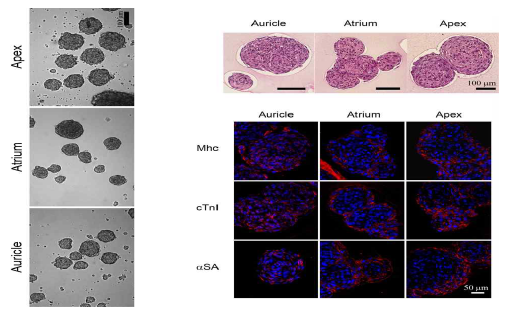 유래조직 별 hCSCs의 미세구 형성시 In vitro 심근세포 분화능 분석