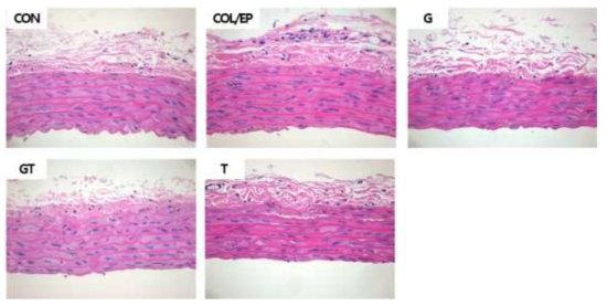 Representative histopathological changes in the aorta tissues (magnification X400 for aorta and X200 for lung, respectively)