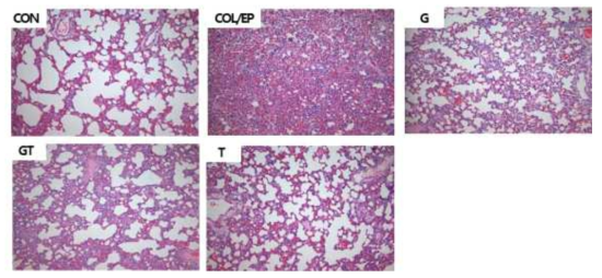 Representative histopathological changes in the lung tissues (magnification X400 for aorta and X200 for lung, respectively)