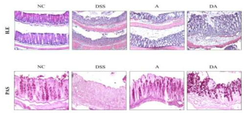 DSS로 염증을 유도한 쥐에 대한 백출포공영의 효능 – 조직병리검사