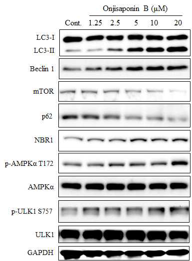 Autophagy 유도 기전 연구