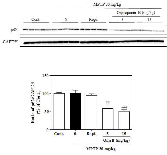 Autophagy 유도 기전 연구