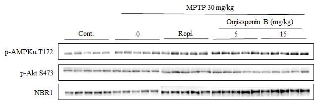 Autophagy 유도 기전 연구