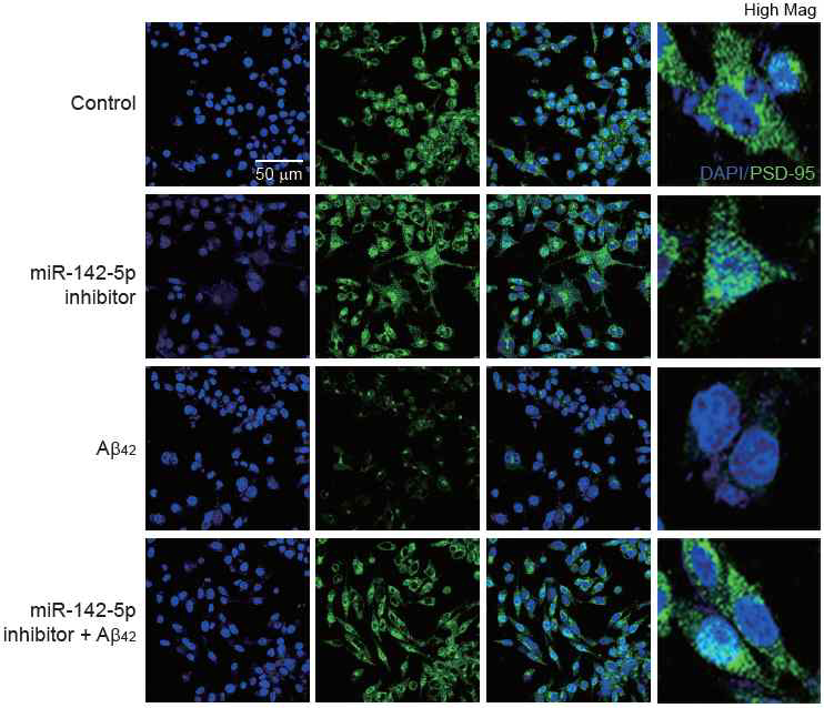 PSD-95 단백질을 시냅스 장애의 표지로 이용하여, 신경세포에서 miR-142-5p를 억제함으로써 amyloid-β에 의한 시냅스 기능장애를 줄일 수 있음을 확인