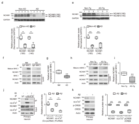 알츠하이머 환자 및 AD 동물 마우스의 뇌에서 NCAM1 발현 및 NCAM1-MHC I 결합감소