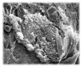 환기관 표면의 생물막 (biofilm)