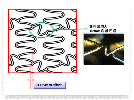 Crown 곡률 및 Strut 각의 최적화 기술