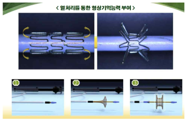 환기관에 열처리 통한 형상기억능력 부여