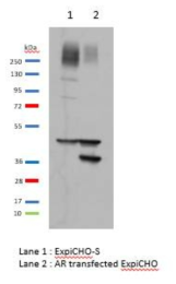 ExpiCHO-S™ 세포에서의 AR 단백질 발현량 비교