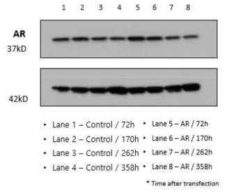 HEK293F 세포에서의 시간대별 AR 발현량 분석