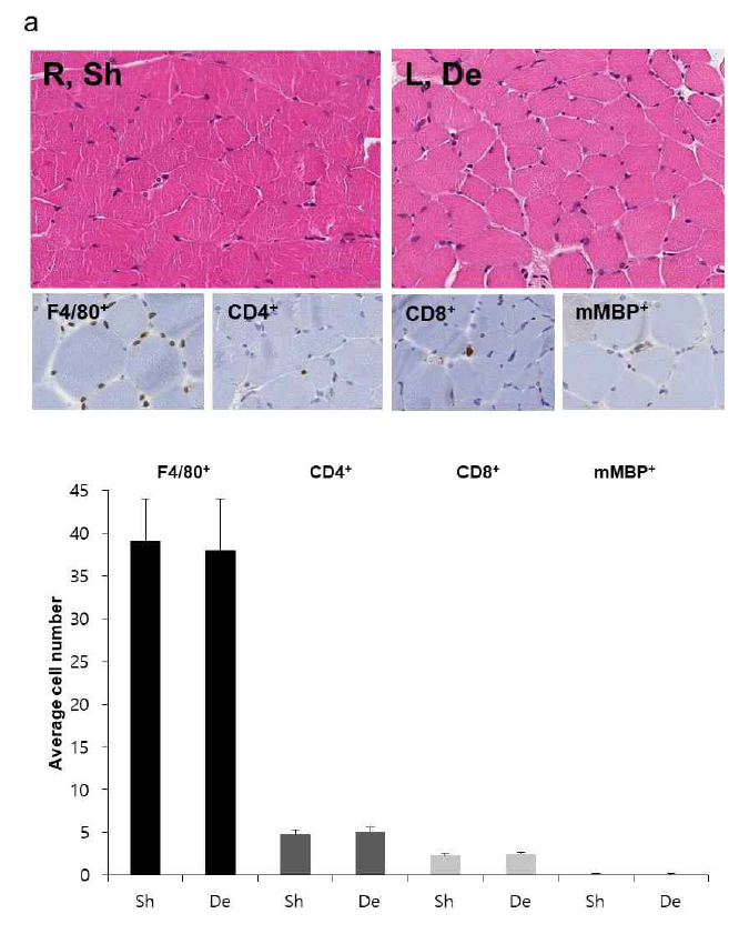 수술 1주 후 전경 골근에서 시행항 H&E 염 색과 면역조직화학염색 (a) 탈신경 근육에서 조직학적 인 탈신경근위축 소견은 보 이지 않았고 면역조직화학 염색에서 골격근내 대식세 포 (F4 / 80 +), CD4양성 T세포 (CD4 +), CD8양성 T세포 (CD8 +) 및 호산구 (mMBP +)의 침윤이 관찰되지 않음 (b) 고배율에서 측정한 세포수 분석에서도 가장수술을 시행한 측에 비해 명확한 증가가 관찰되지 않음