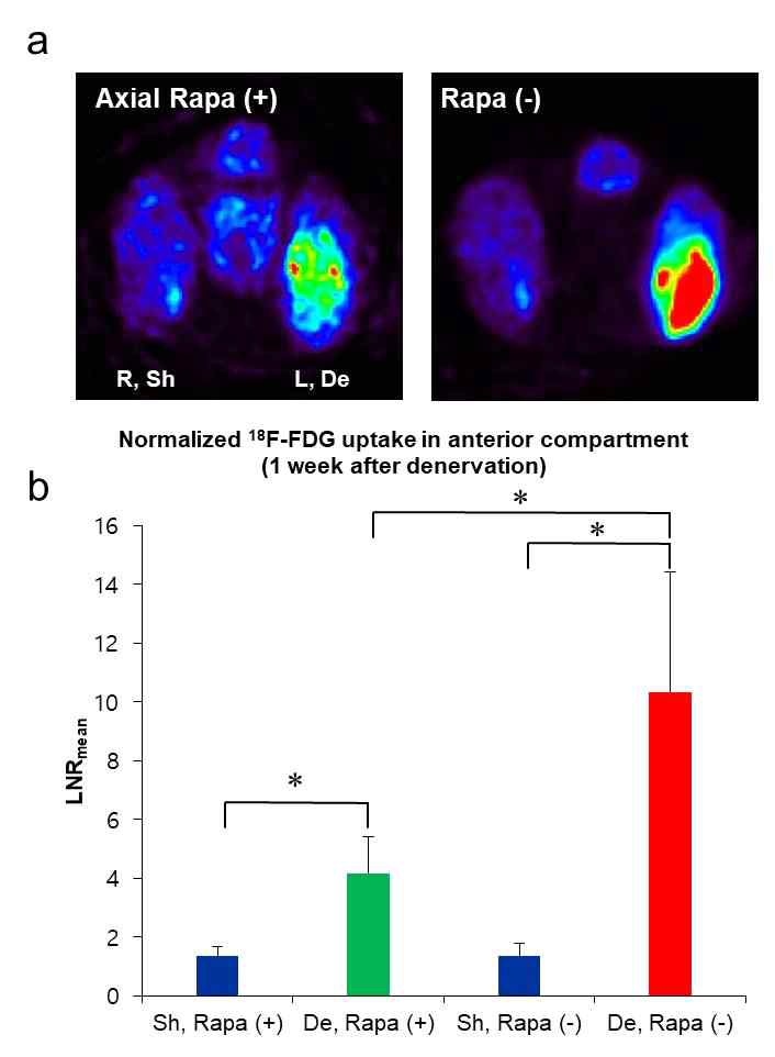Rapamycin을 투여한 쥐에서 탈신경 근육의 FDG 신호의 상대적 감소 (a) 신경손상 1주 후 rapamycin투여된 쥐의 탈신경 근육에서 FDG 신호가 가장수술측에 비해 증가하나 그 정도가 완전손상에 비해 떨어짐. (LNRmean, sham, 1.348 ± 0.321, LNRmean, denervation, 4.185 ± 1.25, n = 5). (b) rapamycin을 투여한 쥐에서 전경골근의 FDG 신호는 투여하지 않은 쥐의 40%정도였고 통계적으로 유의 한 차이를 보임