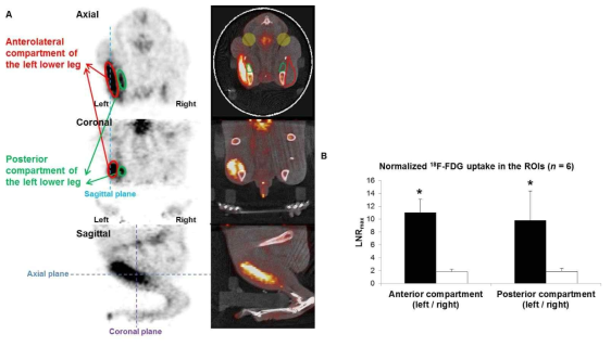 좌측 좌골신경을 절단하고 우측은 가장수술 (sham surgery)를 시행한 백서에서 8일 후 하지에 서 촬영한 18F-FDG PET/CT scan. A) 각각 축상면, 관상면, 시상면 단면영상을 보여주고 있으며 우측 은 CT image와 결합된 영상임. 적으로 표시한 것은 하퇴의 전외측 근육군 나타내며 녹색으로 표시한 것은 하퇴의 후측 근육군 나타냄. 양 근육군 모두 좌골신경의 지배를 받으며 좌측은 탈신경화된 근육군 으로 저명한 FDG 신호의 증가를 관찰할 수 있음. B) 양 근육군 모두에서 표준화된 신호 수치에서도 통계적으로 유의한 FDG의 신호의 증가를 확인할 수 있음. ROIs = Regions of Interest, LNRmax= Maximum Lesion-to-Normal Counts Ratio.*P<0.01